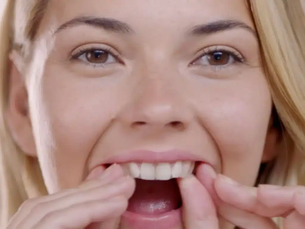 Teeth-Whitening Strips